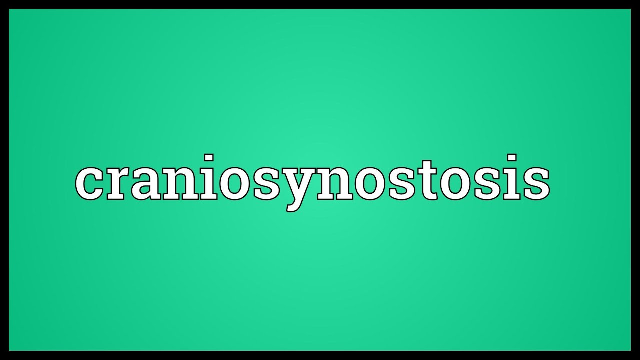 Craniosynostosis Meaning
