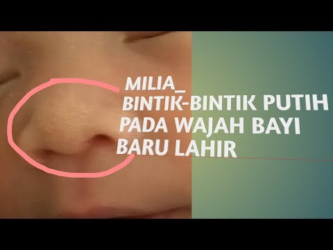 Video: Apakah ruam bayi baru lahir normal?