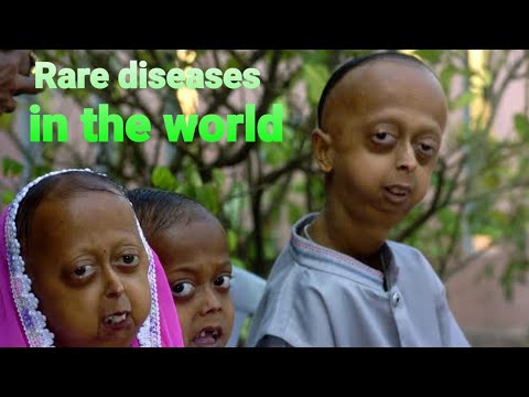 ffi disease ffi disease