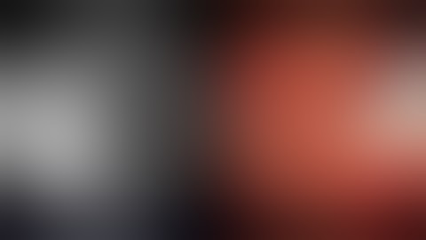 ERCP: MIRIZZI SYNDROME