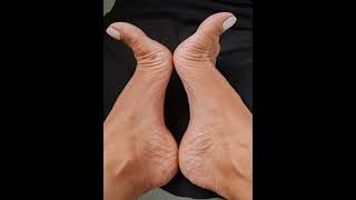 Wrinkles Feet