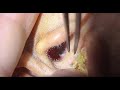 🎯極上の耳掃除 💫眠れない夜に効く耳かきASMR GH2311