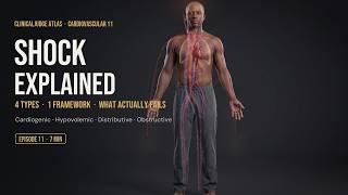 Shock Explained: Cardiogenic, Hypovolemic, Distributive & Obstructive Shock | ClinicalJudge Atlas
