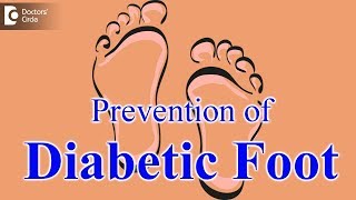 Diabetic foot - Diagnosis, Prevention | Diabetic footwear - Dr. Mohan M R screenshot 5