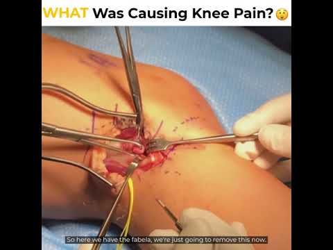 WHAT Was Causing The Pain?