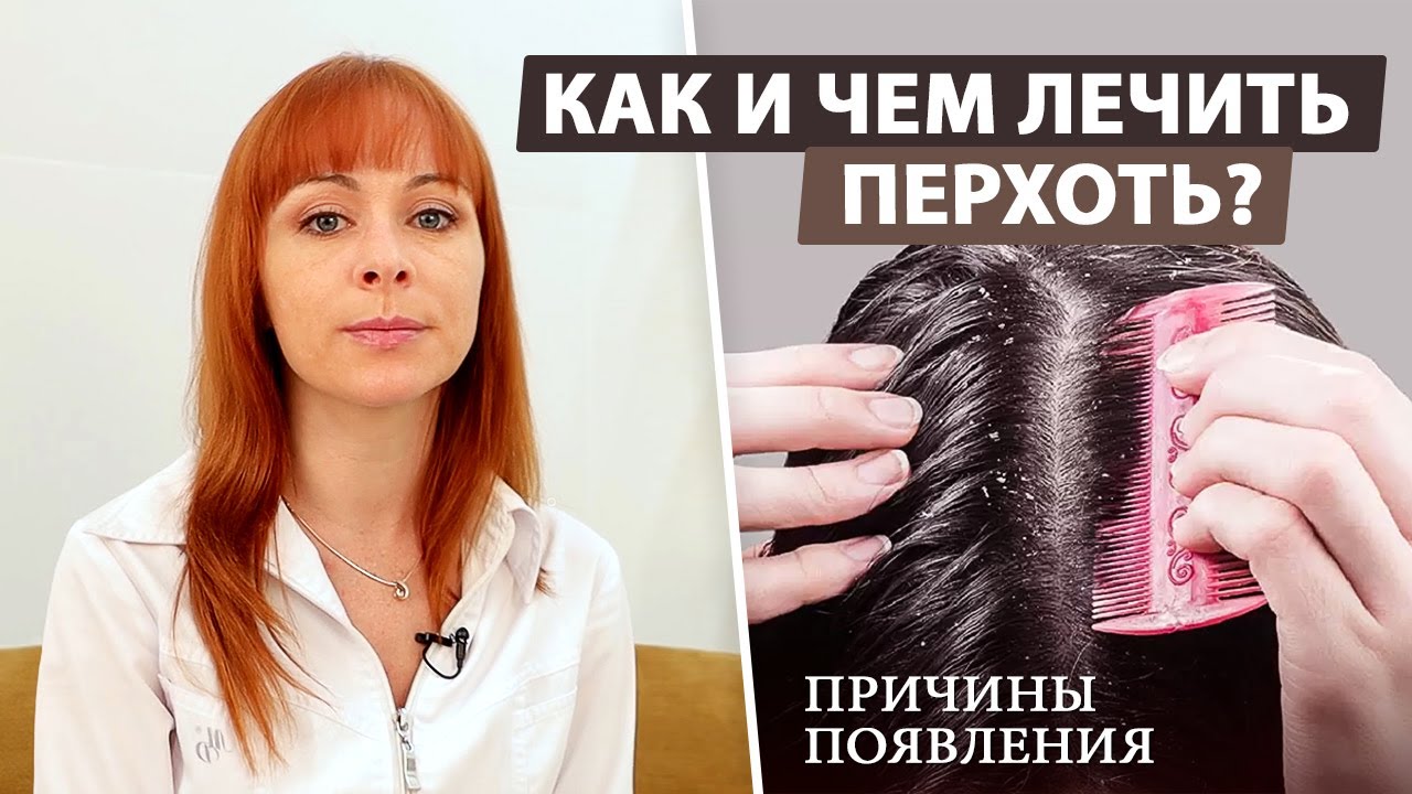 Когда перхоть это норма, а когда нет? - YouTube