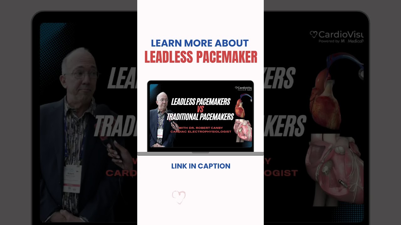 Безэлектродные кардиостимуляторы и для кого они предназначены?