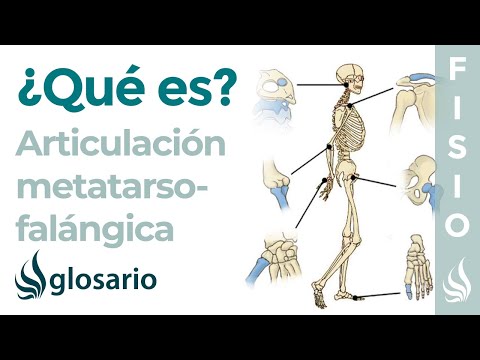 Video: ¿Qué es la artrosis tarsometatarsiana?