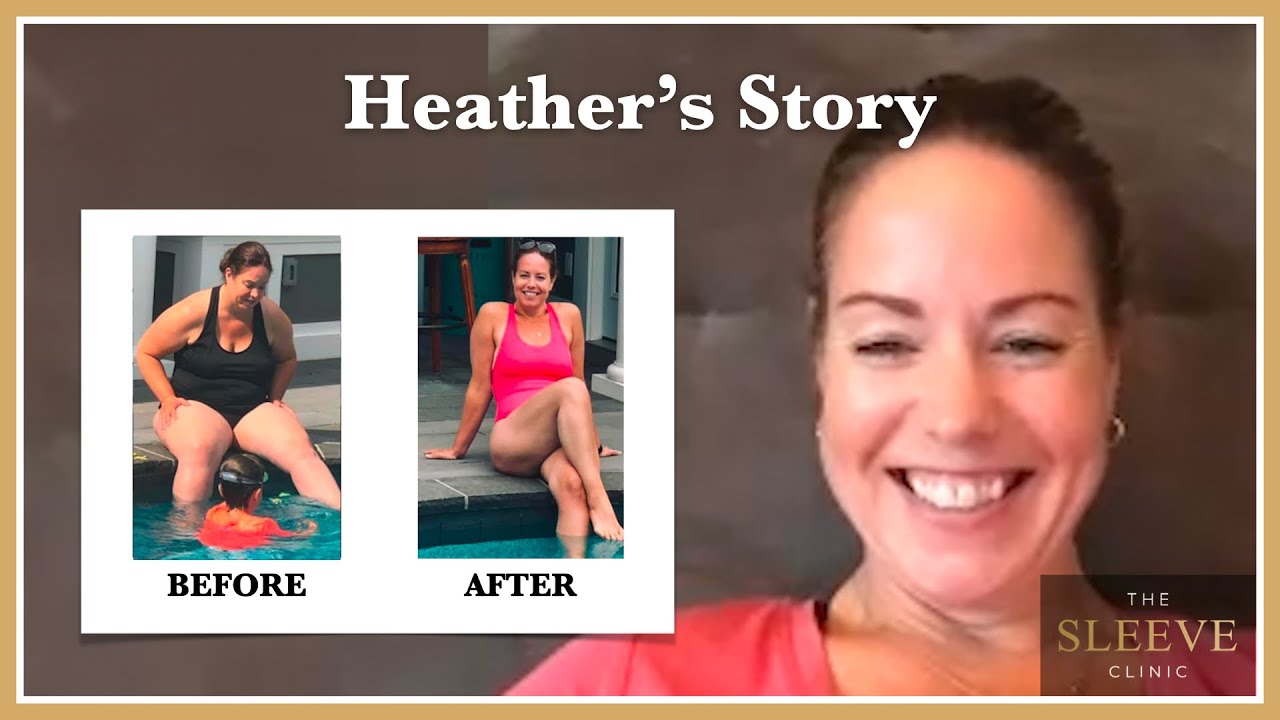 Heather’s Journey To Losing 83 lbs With The Sleeve Clinic