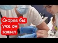 VLOG Снимаем швы на пальчике. Всё сложно