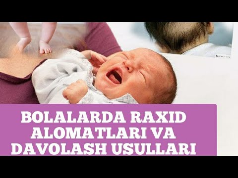 Video: Bolalarda Raxit Kasalligini Qanday Oldini Olish Mumkin