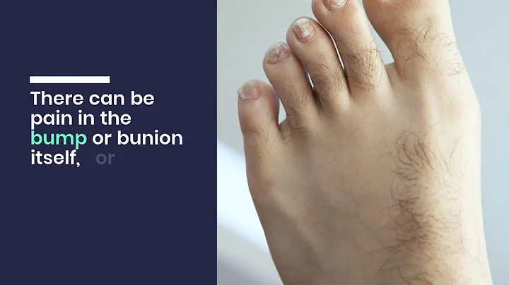 Podiatrist vs. Orthopedist for Bunions - DayDayNews