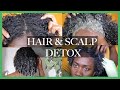 Detoxing My Scalp & Hair Back To Life + Steam Treatment | Nia Imani