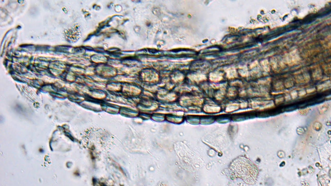 gongylonema pulchrum paraziták