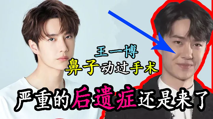 动过鼻子后：后遗症严重，24岁王一博沧桑太快？ - 天天要闻