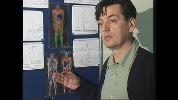 New fat scan test shows that thin people may have hidden fat around their organs