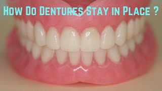 How do dentures stay in place