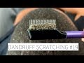 Dandruff Scratching # 19