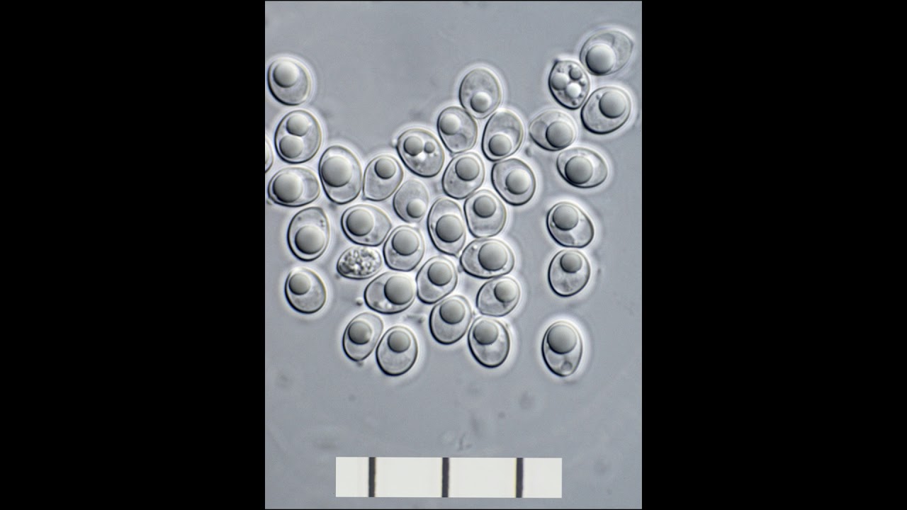 MUSHROOM SPORESMATSUTAKE, CHANTREL, BUTTON YouTube