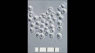 MUSHROOM SPORES-MATSUTAKE, CHANTREL, BUTTON