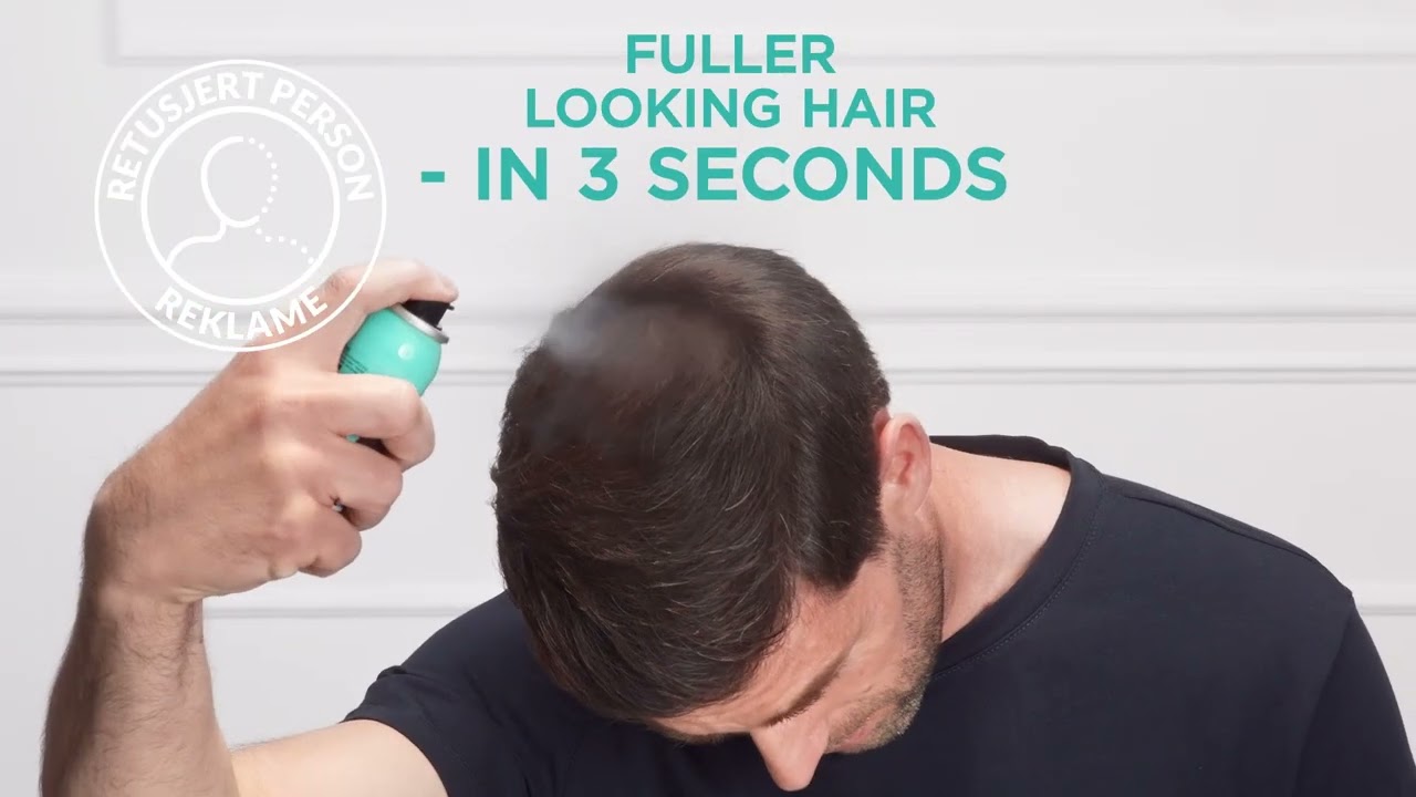 Scalp starting to show?