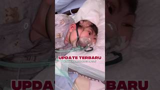 UPDATE TERBARU | Kondisi Anugrah pasca operasi #anugraharshaka #anilestariofficial #anensefali