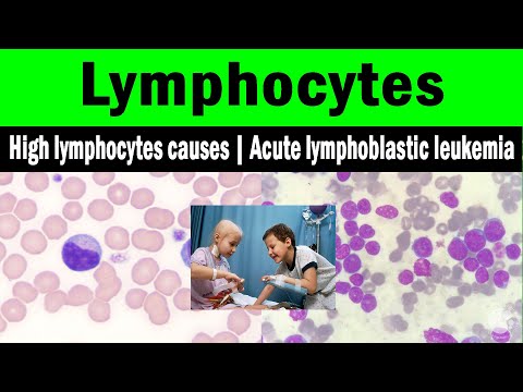 Lymphocytes | High lymphocytes causes | Acute lymphoblastic leukemia