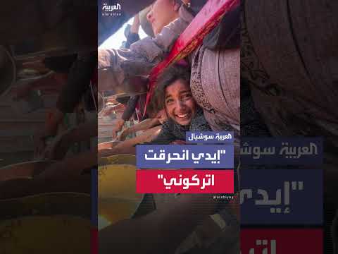 طفلة فلسطينية تصاب بحروق أثناء محاولة إحضار الطعام لأهلها