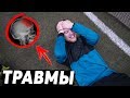 ВСЕ ТРАВМЫ ФИФЕРОВ/ФУТБОЛЬНЫХ БЛОГЕРОВ #2