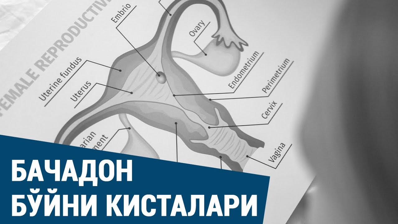 Бачадон бўйни кисталари: сабаблари, белгилари, аниқлаш ва даволаш