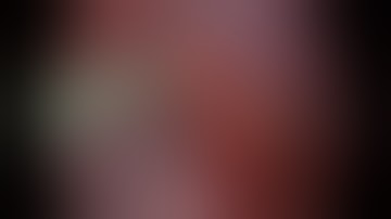 Uniportal VATS right apical (RS1) segmentectomy