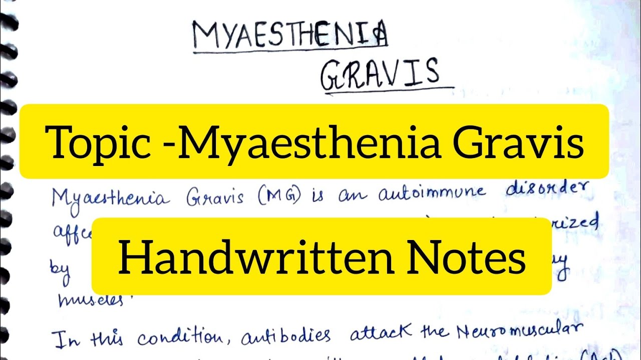 Myaesthenia Gravis Definition Etiology Clinical Manifestations Diagnosis Treatment