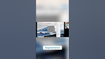 Weka Segmentation  Training Your 3D CT Scan