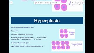 BIO 325 CH4  Cellular Adaptation  CE