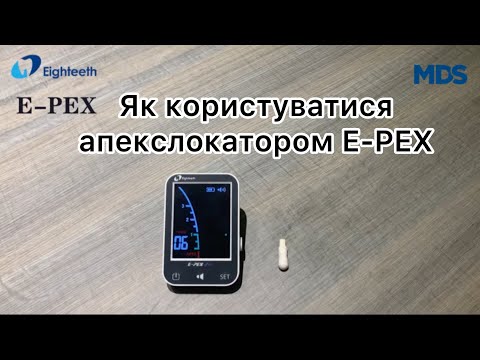 Як користуватися апекслокатором