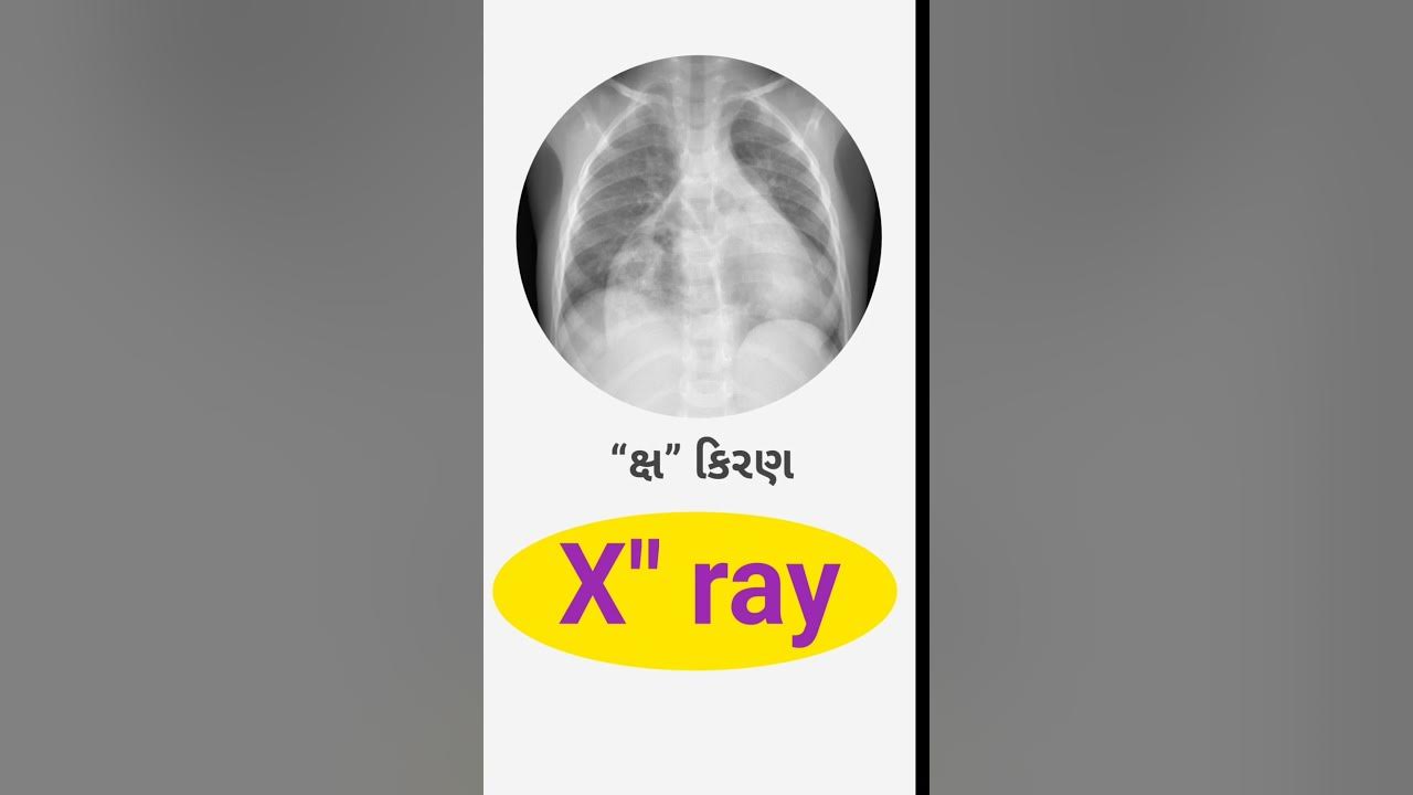 X Ray Meaning In Gujarati English Gujarati Dictionary YouTube x-ray-meaning-in-gujarati-english-gujarati-dictionary-youtube