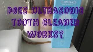 Ultrasonic Tooth Cleaner - Does It Work? Honest Review