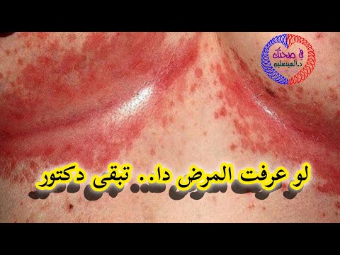 لو عرفت المرض دا تبقى دكتور