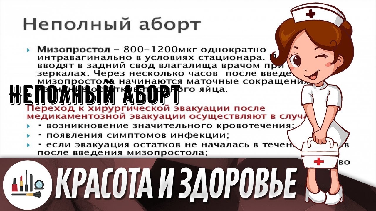 Неполный аборт
