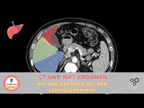 Schnittbildgebung des Abdomens - Wie war das noch mit den Lebersegmenten?