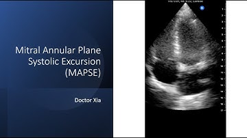Point of Care Ultrasound (POCUS) - Mitral Annular Plane Systolic Excursion (MAPSE) & LVEF