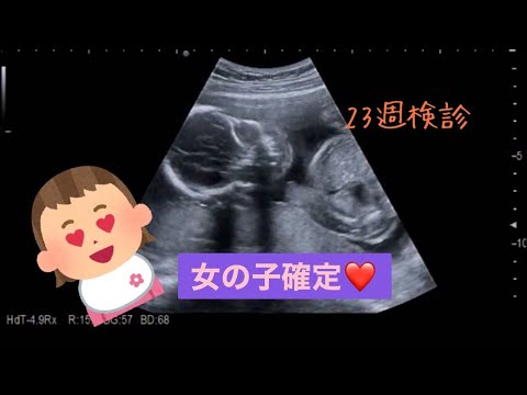 エコー 女の子確定 23週目妊婦検診 Youtube