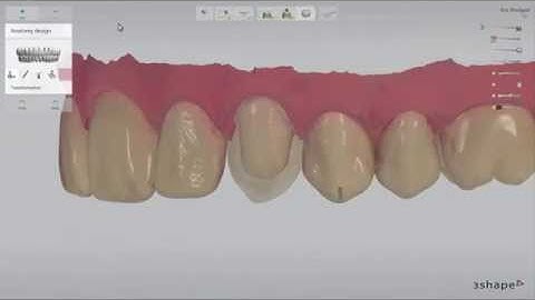 TRIOS® Practice Lab    Crown Workflow