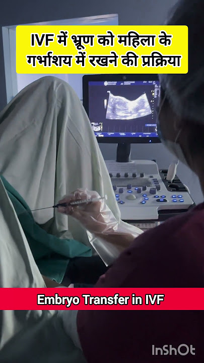 IVF Embryo Transfer by Dr Rakshita Malik #doctor #ivfdoctor #ivfspecialist #mbbs #gynaecologist #ivf