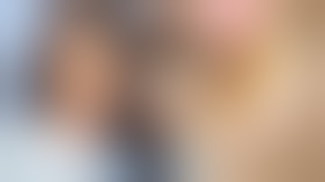 Removing A Horn-Like Growth And 6 Cysts From Woman