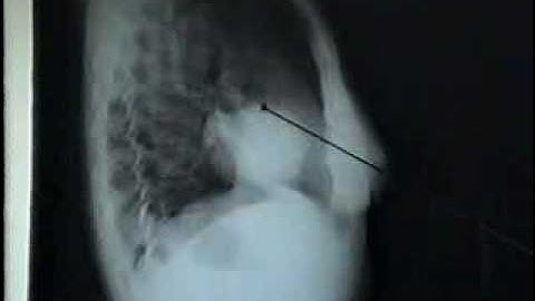 33 u[bacsihoasung.wordpress.com].wmv