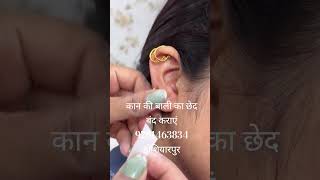 EAR LOBE REPAIR || कान की बाली के छेद बिना तकलीफ के बंद कराएं | SHRI RAM AUSHDHALYA HOSHIARPUR