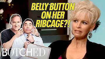 5 FUN Patients on Botched: Flirting, Fupas, and Full Body Surgeries | Botched | E!