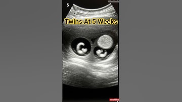 5 Week Twin Pregnancy | Baby Development Inside the Womb