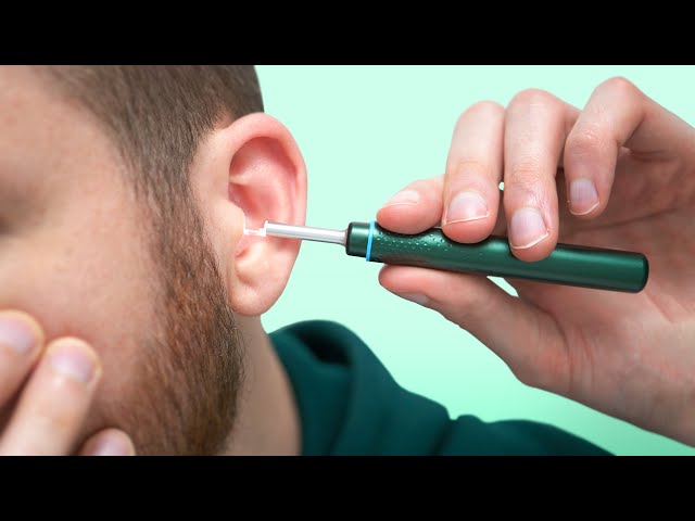 Cet appareil est vraiment déstabilisant ! (otoscope vidéo) 